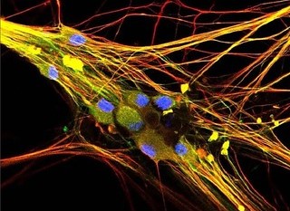 An image of sensory neurons